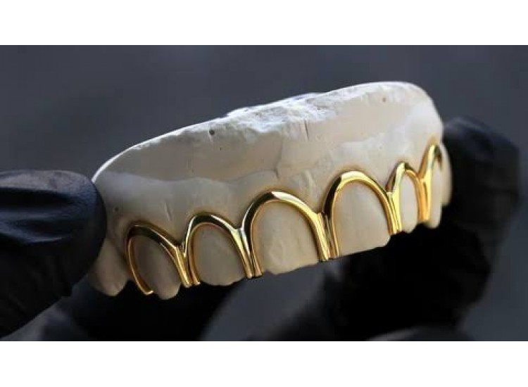 Custom Grillz